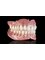 Hampton Village Denture Studio - Complete upper/lower dentures 
