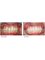 Wimpole Dental - Dental Implants 