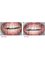Wimpole Dental - Teeth and Gum 