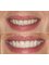 Smile Style Dental Care - 146A Holland Park Avenue, London, W11 4UE,  1