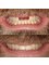 Smile Style Dental Care - 146A Holland Park Avenue, London, W11 4UE,  5