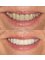 Smile Style Dental Care - 146A Holland Park Avenue, London, W11 4UE,  6