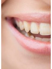 Teeth Whitening - Palcare Dental Practice