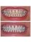 Thurloe Street Dental - Teeth whitening before and after 
