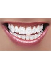 Braces - Keep Smiling Dental Practice