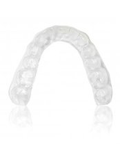 Clear Braces - Keep Smiling Dental Practice