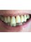 Lovesmile - Dental Implant and Cosmetic Centre - 45 Rodney street, Liverpool, Merseyside, L1 9EW,  3