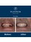 Minto Dental Practice & Implant Centre - Edinburgh - 1 Liberton Gardens, Edinburgh, Midlothian, EH16 6JX,  8
