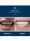 Minto Dental Practice & Implant Centre - Edinburgh - 1 Liberton Gardens, Edinburgh, Midlothian, EH16 6JX,  11