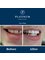 Minto Dental Practice & Implant Centre - Edinburgh - 1 Liberton Gardens, Edinburgh, Midlothian, EH16 6JX,  7