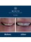 Minto Dental Practice & Implant Centre - Edinburgh - 1 Liberton Gardens, Edinburgh, Midlothian, EH16 6JX,  10