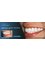 Dental Spa 25 - Teeth Straightening for Adults at Dental Spa 25 