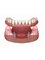 A and L Clinics - Lower Implant Retained Denture  
