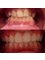 Ortho Keep Smiling - Bearwood Dental Care - 4 St Mary's Road, Bearwood, Birmigham, United Kingdom, B67 5DG,  2