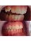 Ortho Keep Smiling - Bearwood Dental Care - 4 St Mary's Road, Bearwood, Birmigham, United Kingdom, B67 5DG,  1