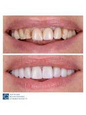 CAD/CAM Dental Restorations - Clinic of Aesthetic Dentistry
