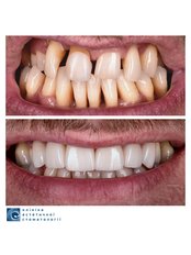 Smile Makeover - Clinic of Aesthetic Dentistry