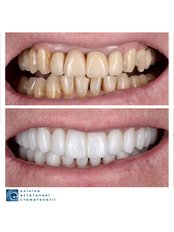 Smile Makeover - Clinic of Aesthetic Dentistry