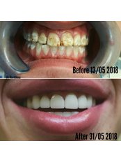 Dentist Consultation - Dental Clinic Dr.Korotkova