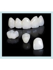 Dental Crowns - Dynasty Dental Clinic - Park Avenue