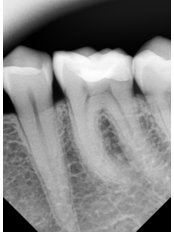 Dental X-Ray - Dynasty Dental Clinic - Park Avenue