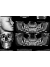 Dental X-Ray - Dynasty Dental Clinic - Park Avenue