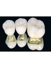 Dental Crowns - Dynasty Dental Clinic - Stand-Alone Building