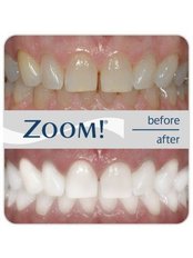 Zoom! Teeth Whitening - Dynasty Dental Clinic - Stand-Alone Building
