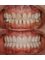 Kalynets Art Dentistry - Ceramic Restoration 