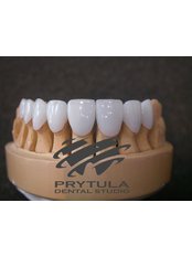 Dental Bridges - Prytula Dental Studio