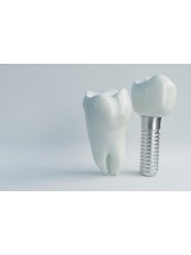 Dental Crowns - Prytula Dental Studio