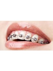 Dentist Consultation - Al Reem Dental CLinic - Dubai