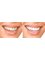 Kyrene Family Dentistry - Chandler AZ - 5965 W.Ray Rd Suite #27, Chandler, AZ, 85226,  12