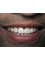 StarBrite Dental- Dr. Munira Lokhandwala - 38350 Fremont Boulevard, Suite 103, Fremont, CA, CA, 94536,  5