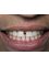 StarBrite Dental- Dr. Munira Lokhandwala - 38350 Fremont Boulevard, Suite 103, Fremont, CA, CA, 94536,  1