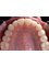 StarBrite Dental- Dr. Munira Lokhandwala - 38350 Fremont Boulevard, Suite 103, Fremont, CA, CA, 94536,  8