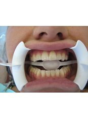 Cosmetic Dentist Consultation - Artmond Louie, D.D.S. Inc.