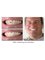 South Tampa Dentists - Ed Francisco DDS - 2210 S MacDill Ave, Tampa, FL, FL, 33629,  6