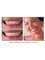 South Tampa Dentists - Ed Francisco DDS - 2210 S MacDill Ave, Tampa, FL, FL, 33629,  5