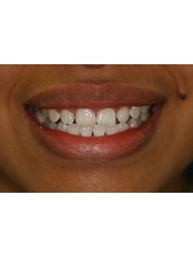 Cosmetic Dentist Consultation - Wesley Chapel Dentistry