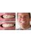 Radiant Smiles Dental: Wu Grace E DDS - Dentures 
