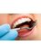 Steckbeck Family Dentistry - 8007 S. Meridian Street, Indianapolis, Indiana, 46217,  6
