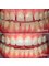 Family & Cosmetic Dentistry Allen - 915 W Exchange Pkwy #170, Allen, TX, Texas, 75013,  13