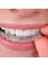 Austin Family Orthodontics - 12501 Hymeadow Dr #1D, Austin, TX, FL, 78750,  3