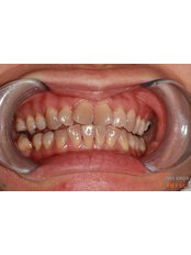 Cosmetic Dentist Consultation - Viet Uc Dental Clinic