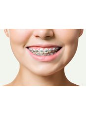 Standard Metal Braces - Camtu Dental Clinic