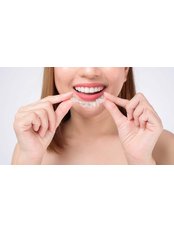 Orthodontic Retainer - Camtu Dental Clinic