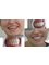 Platinum Dental Group - Smile veneers 