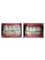 Platinum Dental Group - Smile makeover 