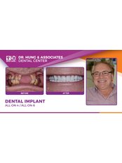Dental Implants - Worldwide Dental & Cosmetic Surgery Hospital (fka Dr. Hung & Associates Dental Center)